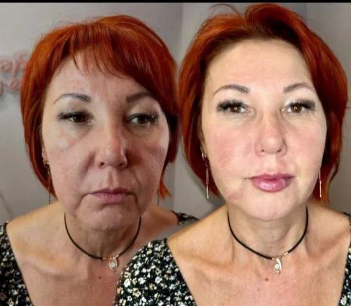 25 лет безупречной практики в эстетической медицине. — Батуми