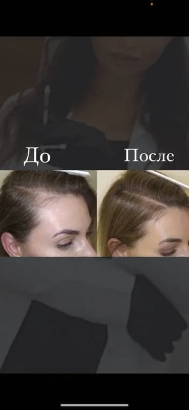 9.000 драм — Ереван — 9,000 ֏